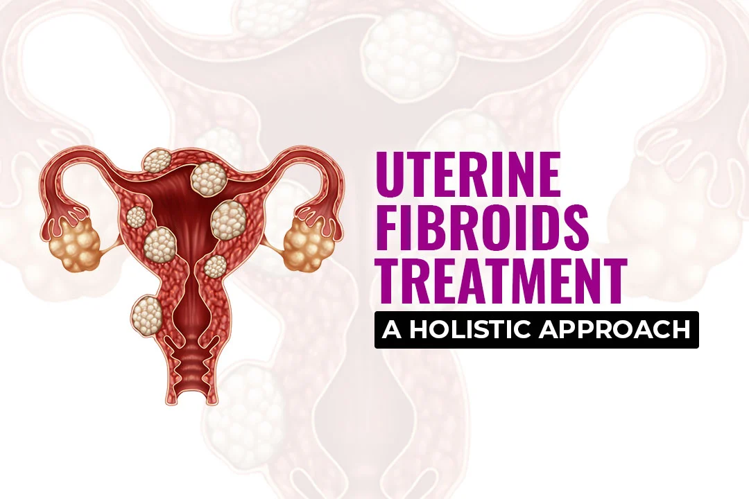 Uterine Fibroids Treatment Doctor in Faridabad