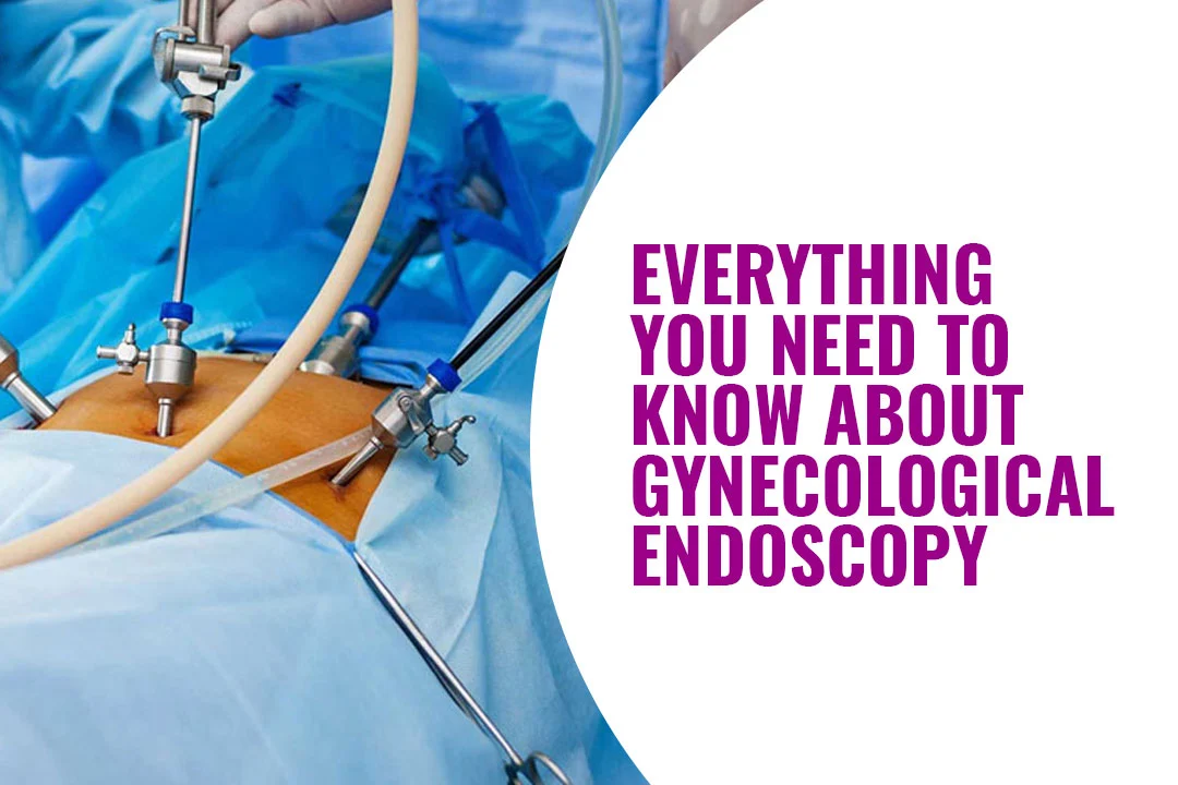 Gynecological Endoscopy